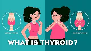 Thyroid Gland T3 T4 Thyroid Hormones and Thyroid Problems Animation thyroid [upl. by Dole804]