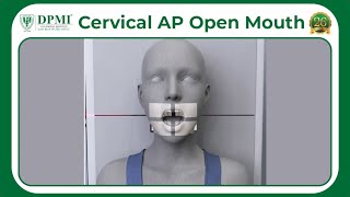 Cervical AP Open Mouth AP Cervical Spine XRay with Open Mouth What is C1 and C2 Vertebrae [upl. by Eustache]