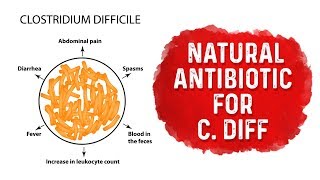 Prevention and Management of C Difficile Colitis [upl. by Lotta]