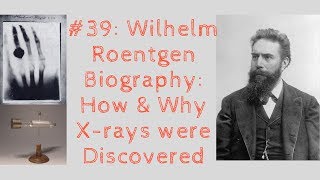 Wilhelm Roentgen Biography How amp Why Xrays were Discovered [upl. by Sashenka33]