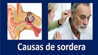 9 Causas comunes de sordera tinnitus y daño al oído [upl. by Ecam]