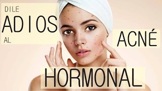 Cómo eliminar el ACNÉ HORMONAL 100 NATURAL [upl. by Heinrick]