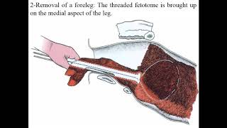 Fetotomy [upl. by Ciredec]