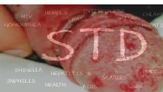 STD Sexually Transmitted Diseases NCERT Tricks [upl. by Nodroj]