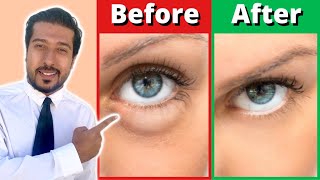 How to Improve Eyesight With Best Exercise – Dr Berg [upl. by Barraza671]