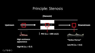 Doppler Ultrasound Part 1  Principles w focus on Spectral Waveforms [upl. by Beckman]