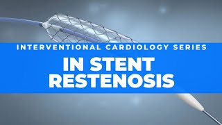 In stent restenosis  Risk factors pathology identification and management [upl. by Paola157]