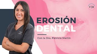 EROSIÓN DENTAL ¿Por qué se produce el DESGASTE de los DIENTES✨ [upl. by Sklar]