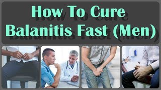 How To Cure Balanitis With Oils Fast And Causes Symptoms And Treatment Of Balanitis [upl. by Barkley698]