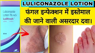 Luliconazole Lotion 1 wv [upl. by Hyams401]