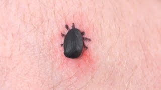 DEADLIEST TICK EVER [upl. by Bille]