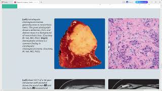 LIVER DIAGNOSTIC IMAGING SERIES [upl. by Selrac]