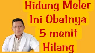 CARA MENGOBATI HIDUNG MELER  RHINITIS ALERGI [upl. by Adnamahs]