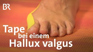 Was tun beim Ballenzeh  Tape bei einem Hallux valgus  Anleitung  Fußpflege  Ballen [upl. by Haya54]