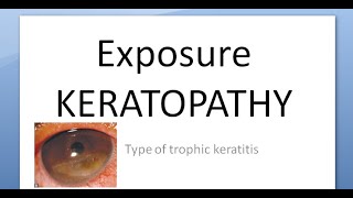 Ophthalmology 124 a Exposure KERATOPATHY Keratitis Causes Corneal Dry [upl. by Wolfson452]