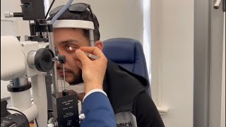 Keratoconus treatment One Week follow up after Corneal Crosslinking CXL Live footage [upl. by Otrebron]