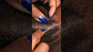 ASMR scalp scratching old cornrows with Blowing Sounds asmr asmrsounds flakes [upl. by Melbourne]