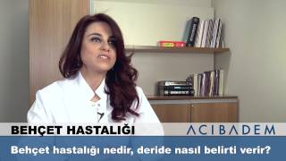 Behçet hastalığı nedir deride nasıl belirti verir [upl. by Vaules116]