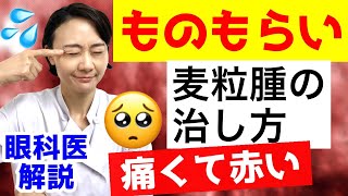 【ものもらい】麦粒腫の治し方！（痛くて赤い）眼科医解説！ [upl. by Ahsiekal]