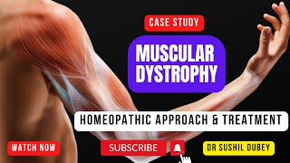 Muscular Dystrophy Homoeopathy Treatment and Case Study [upl. by Anaihk]