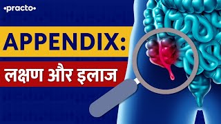 Appendix What Are Symptoms of Appendicitis  Appendicitis Treatment In Hindi  Practo [upl. by Launam712]