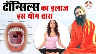 Baba Ramdev  उज्जायी प्राणायाम से ठीक करे बच्चों का टॉन्सिल 1 दिन में  How to do Ujjayi Pranayam [upl. by Nortal]