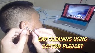 Ear Cleaning using Cotton Pledget [upl. by Kitchen735]