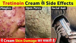 Tretinoin Cream के ये Side Effects आप नहीं जानते होगे 😱 [upl. by Auroora]