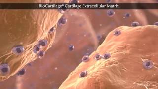 Basic Sciences  Articular cartilage [upl. by Andrien]