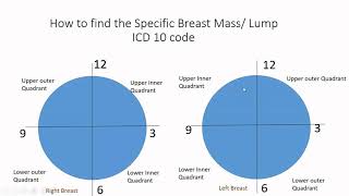 Reasons for a Breast Lump  Dr Indu Bansal Aggarwal [upl. by Nnahtur]