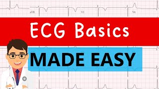 ECG basics  EASY GUIDE FOR MEDICAL STUDENTS [upl. by Adnuahsor56]