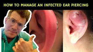 How to recognise manage and treat an infected ear piercing  Doctor ODonovan explains [upl. by Asante]