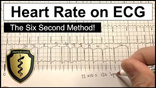 ECG Heart Rate Calculation  The Six Second Method [upl. by Ybrad]