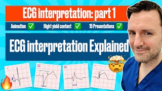 Understanding ECGs  EKG [upl. by Isdnil]