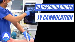 Intravenous IV Cannulation under Ultrasound US guidance  5 steps to optimise your view [upl. by Laith]