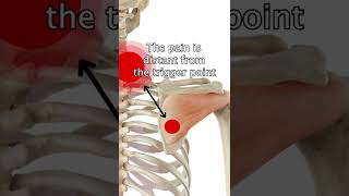 Infraspinatus Trigger Points [upl. by Annaeed]