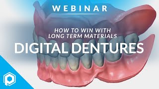 How to Design and 3D Print Digital Dentures  Digital Dental Workflow [upl. by Rorrys]