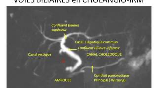 foie et voies biliaires 2 partie 3 [upl. by Lockhart]