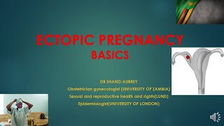 ECTOPIC PREGNANCY DIAGNOSIS AND MANAGEMENT BASICS [upl. by Assela]