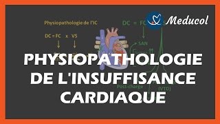 OAP Oedème Aigu du Poumon sur Insuffisance cardiaque gauche chronique Échographie Urgences [upl. by Everrs990]