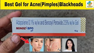 Minoz BPO Gel Use in Hindi  Minoz BPO Gel Benefits Side effects  Acne  Blackheads  SK Medicine [upl. by Laamaj226]