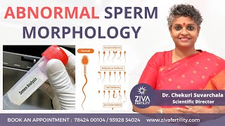 Abnormal Sperm Morphology  Male Infertility  Dr Chekuri Suvarchala  ZIVA Fertility [upl. by Jacob]