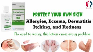 Betaderm Lotion uses benefits and side effects in UrduHindi [upl. by Nesnej576]