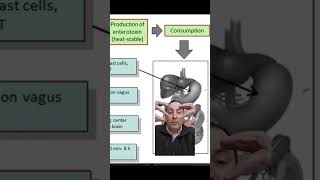 Staphylococcus Aureus en manipuladores de alimentos [upl. by Oirasor]