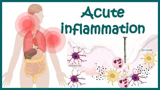 Acute Inflammation  symptoms Pathogenesis Cause of inflammation Mediators of Acute Inflammation [upl. by Airdnaid]