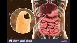 Nématodes transcutanés ankylostomose ancylostoma duodénale necator Americanus 3eme année médecine [upl. by Suivart]