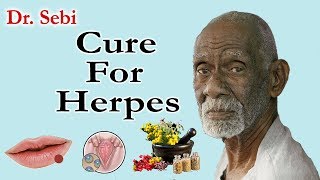 How Dr Sebi Cured Herpes  Complete Guide To Dr Sebi Cure For Herpes [upl. by Laen950]