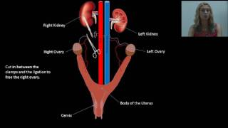 Small Animal Spay Procedure [upl. by Temme]