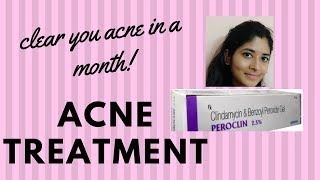 Acne treatment  in a month   Peroclin 25 Review [upl. by Chyou]