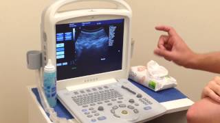 Real Time Ultrasound Rehabilitation of Multifidus [upl. by Esertak]